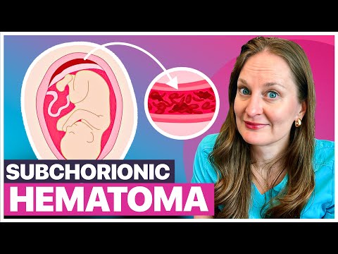 Subchorionic Hematoma and Bleeding in Pregnancy: What to Expect and How to Manage It