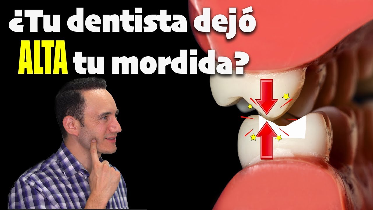 Watch TE VAS A ACOSTUMBRAR: Lo que tu dentista NO debería decirte si tu resina o corona queda ALTA Now TE VAS A ACOSTUMBRAR: Lo que tu dentista NO debería decirte si tu resina o corona queda ALTA