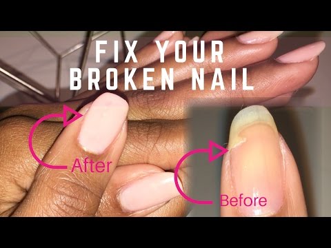 How to Fix a Broken Nail With A Tea Bag! | natural nail repair