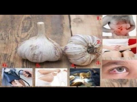 Kujdes! Këto janë katër rastet kur nuk duhet të konsumoni hudhër sipas ekspertëve