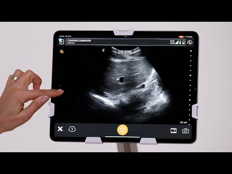 Adjusting Dynamic Range
