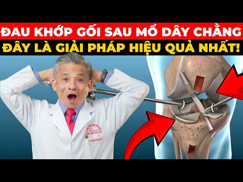 9/10 Người Việt Hết Đau Khớp Gối Sau Mổ Dây Chằng Chéo Nhờ Phương Pháp Này!