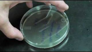 Plate Streaking - WPI | Worcester Polytechnic Institute