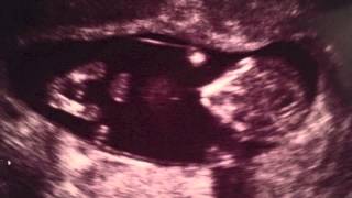 Priscilla & Antonio Gender Reveal May 2014