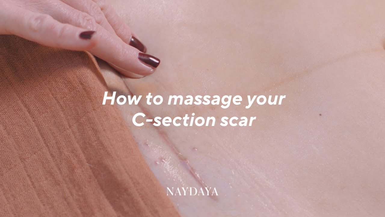 How to Massage your C Section Scar | with Clare Bourne Physio