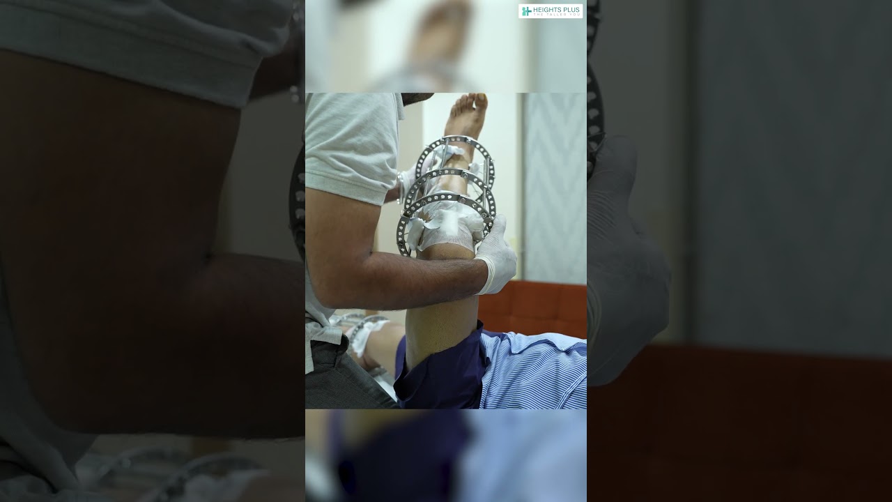 Faster Recovery Starts Early 💚 | HeightPlus Physiotherapy | Post-Surgery Rehab Journey"