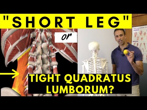 How to fix a SHORT LEG: Heel lift or not?