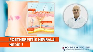 Postherpetik Nevralji Nedir ?