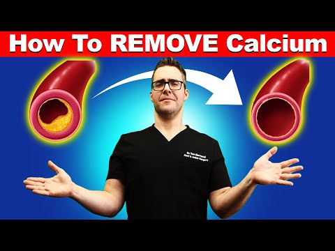 How To REMOVE Calcium From Your Arteries? [Top 15 Vitamin K2 Foods]