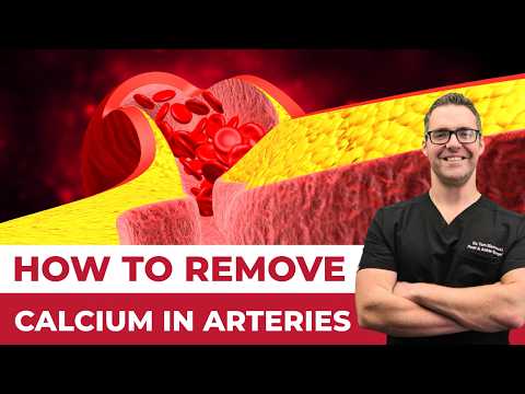 The 1 Calcium Osteoporosis Vitamin D BIG MISTAKE