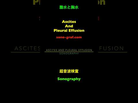 胸水分析公式