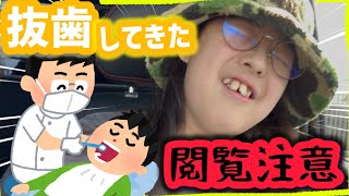 矯正のため、抜歯してきた。 #歯列矯正 #抜歯 #子ども  