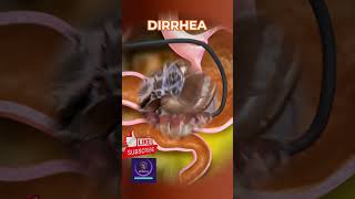 Download lagu Diarrhea Formation: Causes, Mechanism, and Prevention Explained mp3