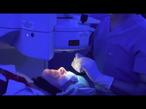 Multi focal Cataract Surgery; Can it be Corrected? YES!