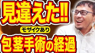 【まるで違う！】昔に包茎治療失敗... 手術から２週間後の状態をリアル公開