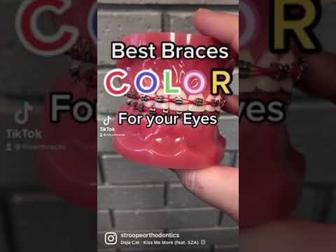 BEST Braces color that matches your EYES