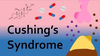 Cushing's Syndrome and Corticosteroids (Part 2)
