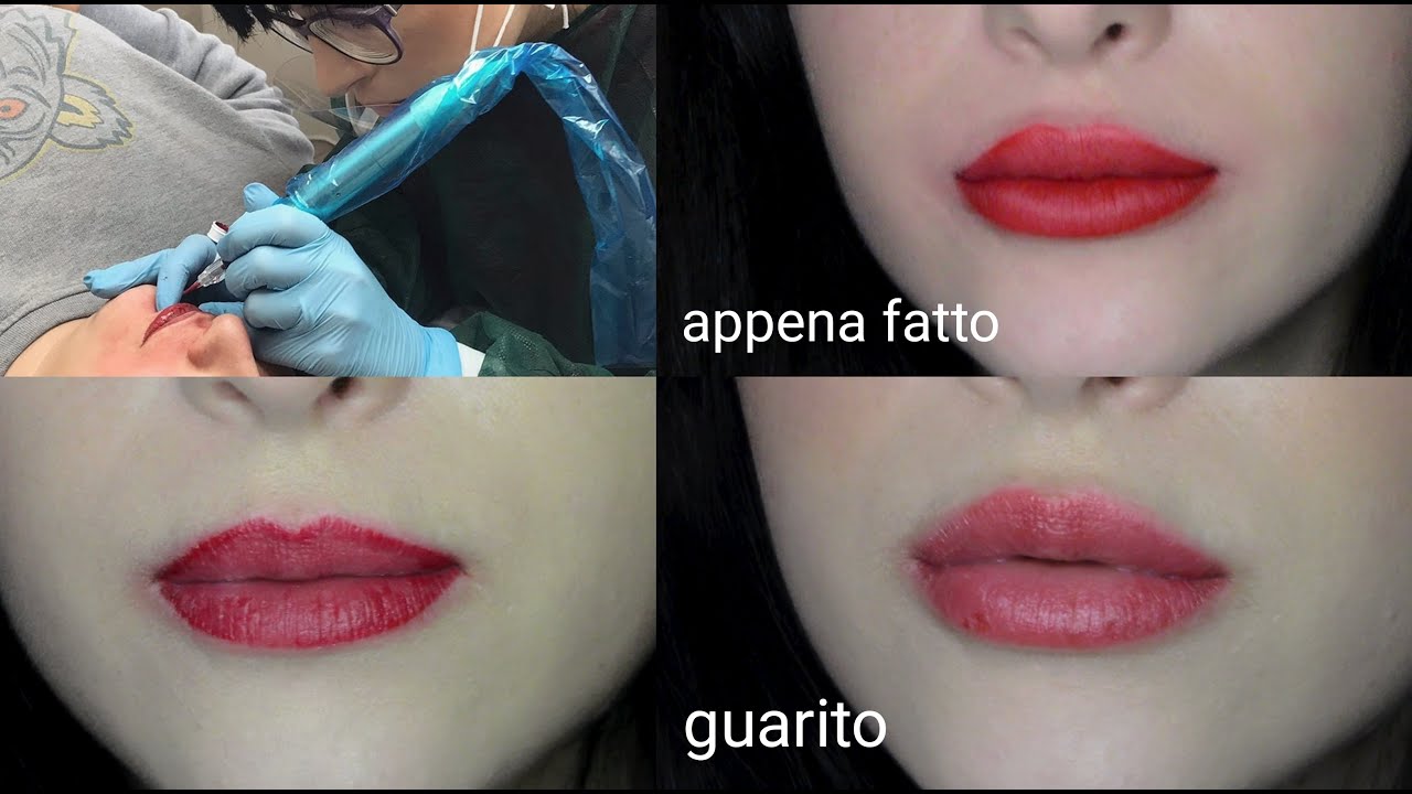 TATUAGGIO LABBRA, SPIEGAZIONE E GUARIGIONE