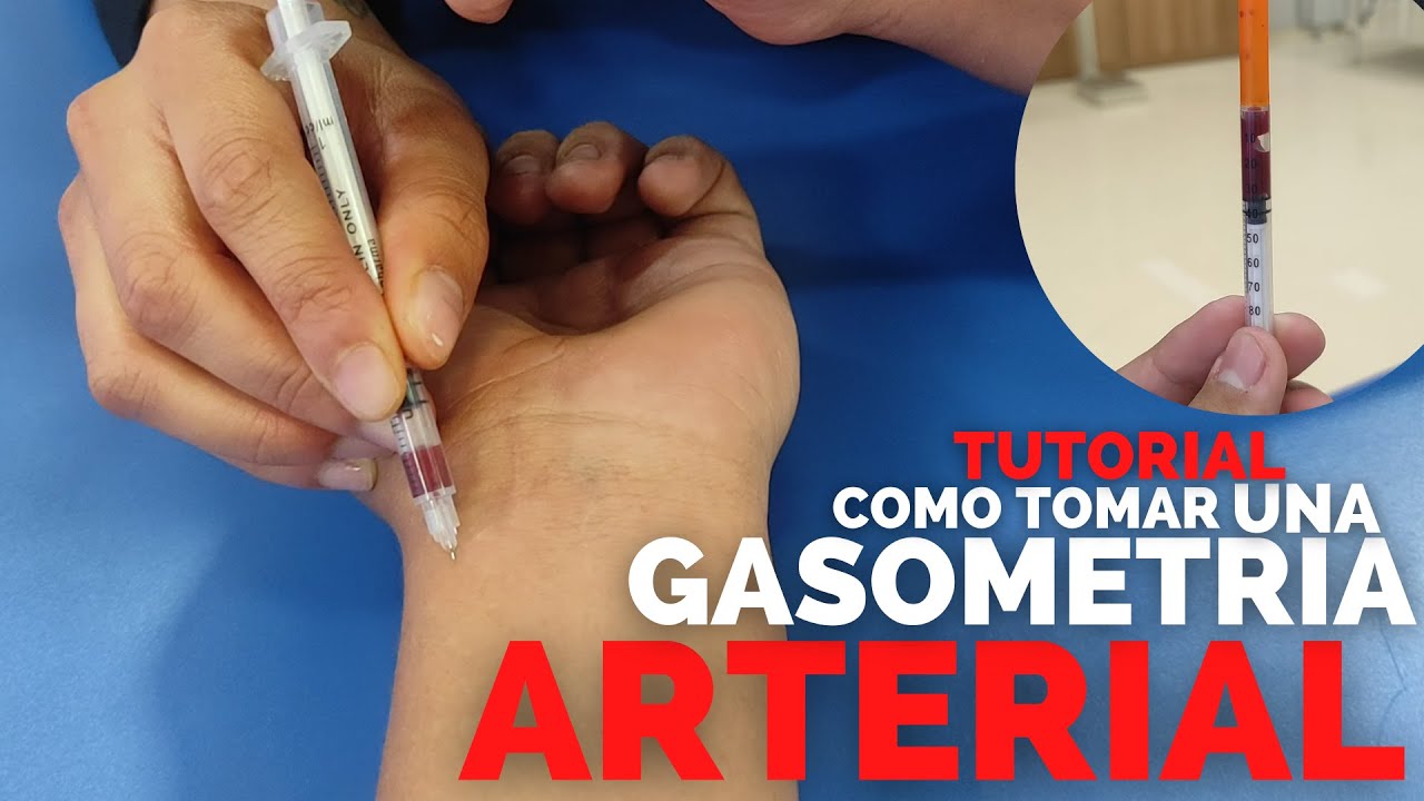 ✅Como TOMAR UNA GASOMETRIA ARTERIAL | TUTORIAL | ENFERMERIA