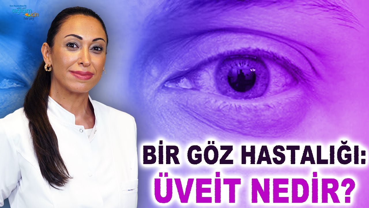 Bir Göz Hastalığı: Üveit Nedir, Nasıl Tedavi Edilir?