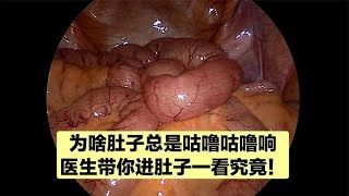 肚子总是咕噜咕噜响？原来是肠管在动，医生带你进肚子里一看究竟