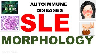 Autoimmune diseases |Part 5| Systemic Lupus Erythematosus |MORPHOLOGY