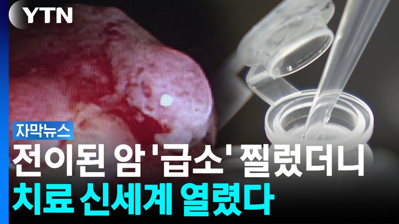 '전이암' 치료 대혁명...약점 찾아내자 암세포 생존율 '뚝' [자막뉴스] / YTN