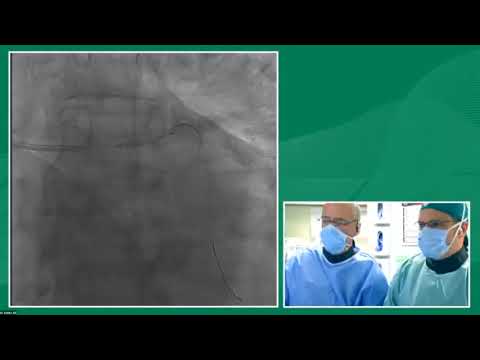 Live Case from Humanitas Research Hospital, Milan, Italy || BDINTERVENTION 2021