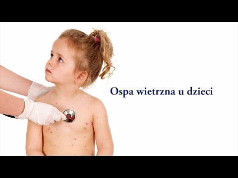 Zwiększoną siłę jedzenie Opinie sprzęt torus