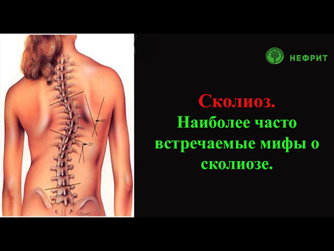 Диспластический сколиоз 2 степени лечение Корсет поясничный меди