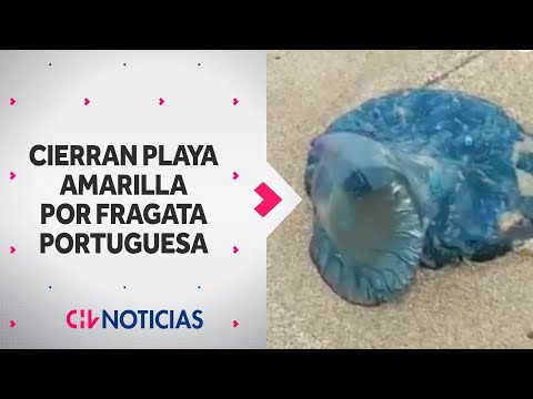 Prohíben baño en playas de Concón y Algarrobo por fragata portuguesa: ¿Qué hacer si te pica?