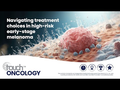Navigating treatment choices in high-risk early-stage melanoma