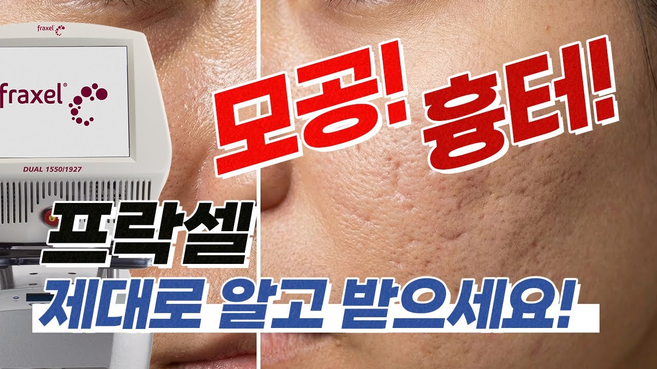 여드름 흉터 프락셀, 장비 이름보다 흉터 깊이를 먼저 봐야 한다