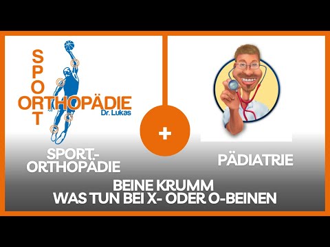 Beine krumm - Was tun bei X-/O-Beinen: Der Orthopäde trifft den Kinderarzt