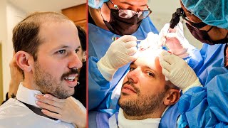 This Hair Transplant Changed My Life!