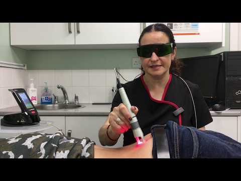 Treating Sciatica using a K-Laser in our Swindon clinic