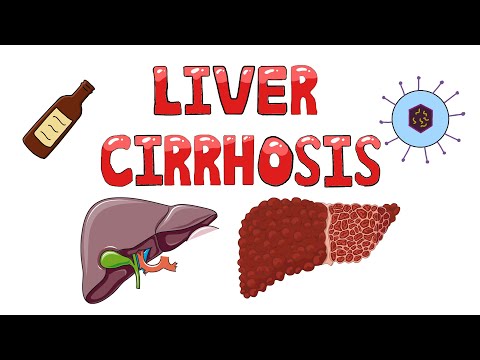 Liver Cirrhosis - What happens in Liver Cirrhosis? | Pathophysiology, Causes, Signs & Symptoms