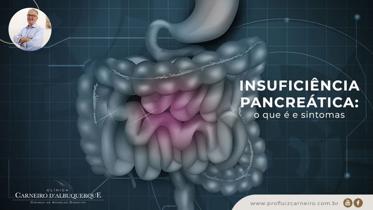 Insuficiência pancreática: o que é e sintomas | Prof. Dr. Luiz Carneiro CRM 22.761