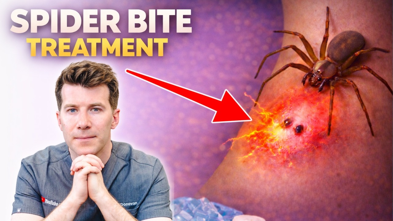 Spider Bite Treatment: When It’s Harmless vs Dangerous