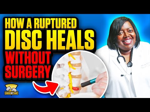 How a Herniated Disc Heals Naturally Without Surgery | Doctor Explains