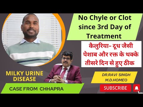 Chyluria for 3 Months Cured in 3 days with Homeopathy Dr Ravi Singh