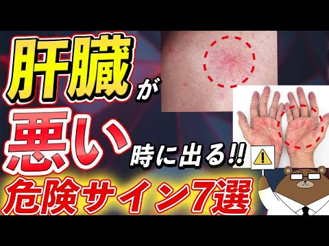 肝臓に悪い13の食べ物