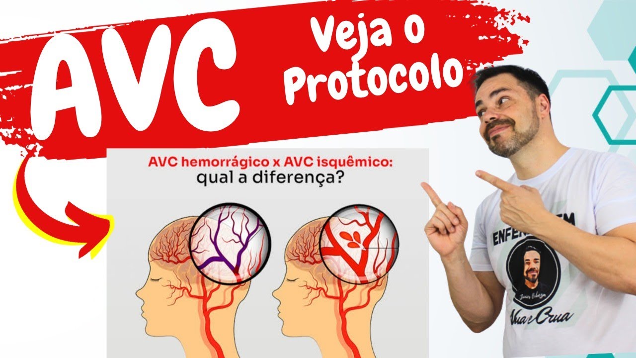AVC  Linhas de cuidados - Este vídeo vai te SURPREENDER