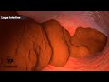 How Does Your Body Turn Food Into The Poop Human Digestive System Animation Dandelion Team