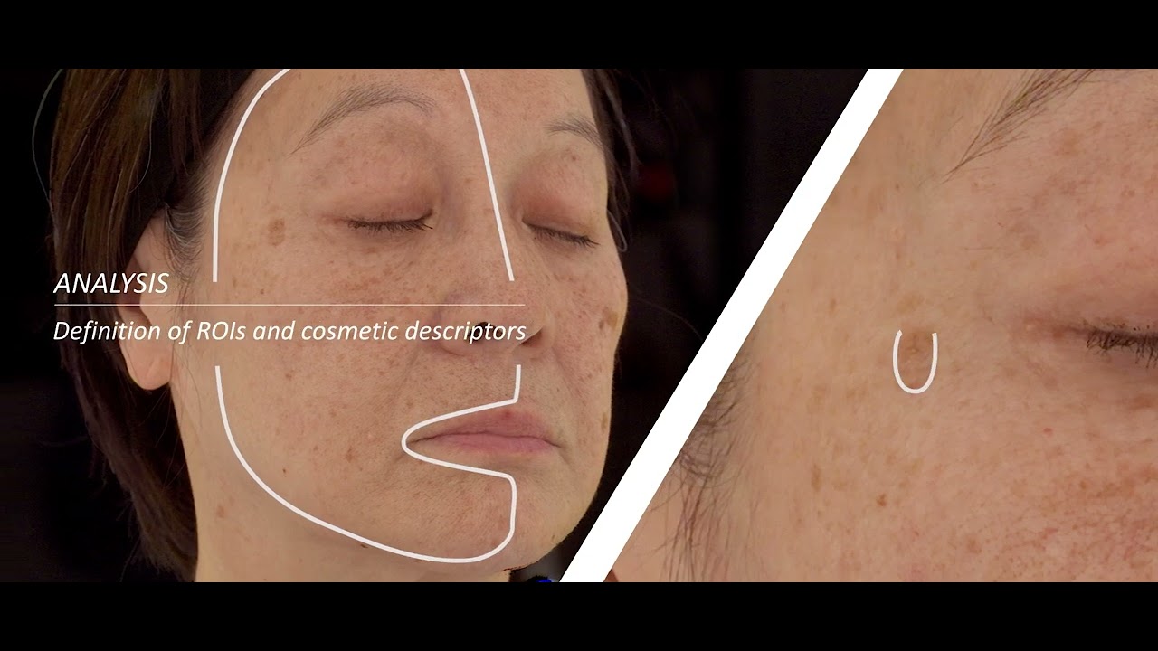 Proving Whitening Serum Efficacy with 3D Evaluation & Simulation | Cydolia