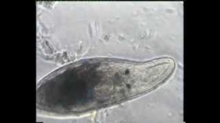 preview picture of video 'A journey to the world of invisible animals - Part 14: Platyhelminthes'