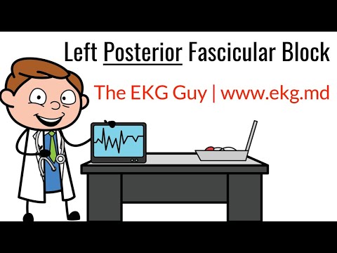 Left Posterior Fascicular Block on EKG / ECG l The EKG Guy - www.ekg.md