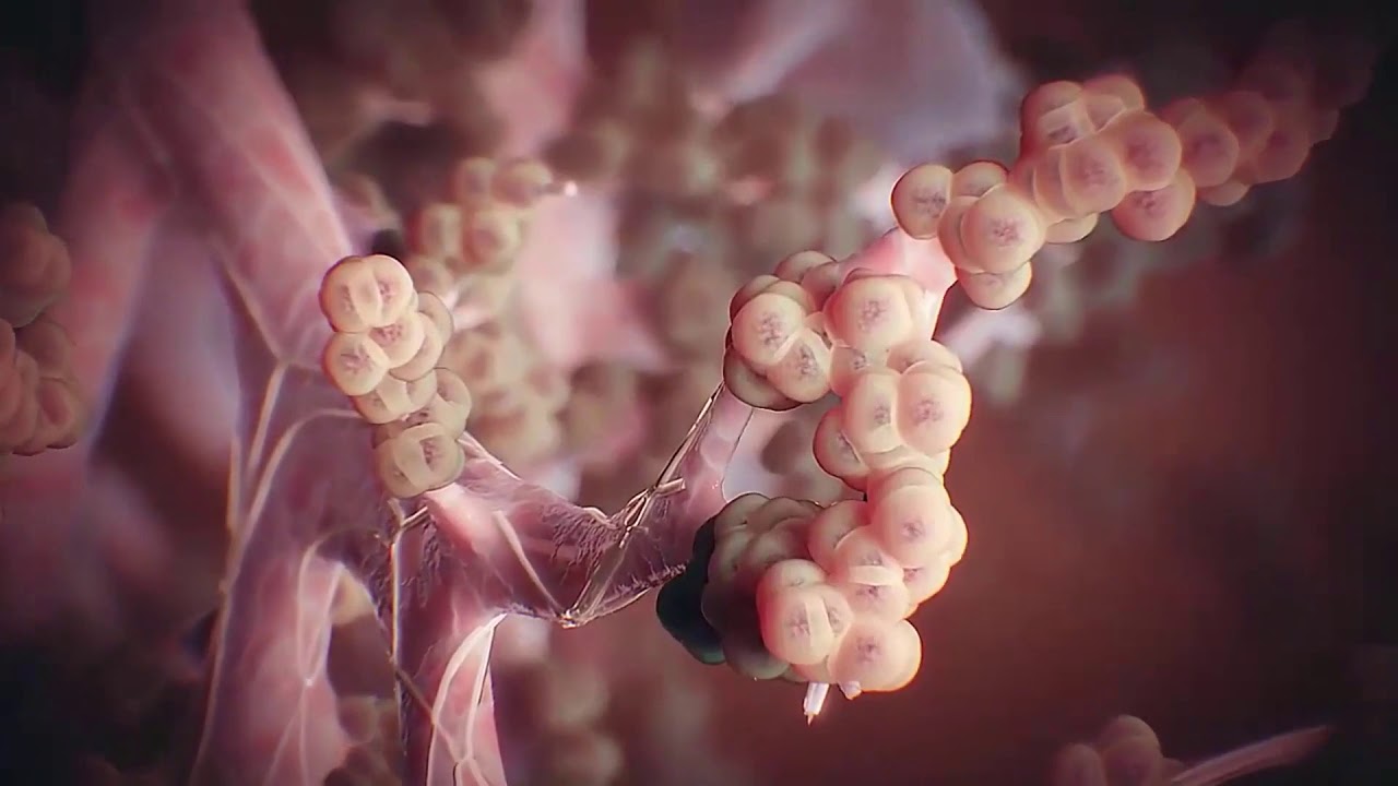 Cuál es la diferencia entre el lupus y la fibromialgia