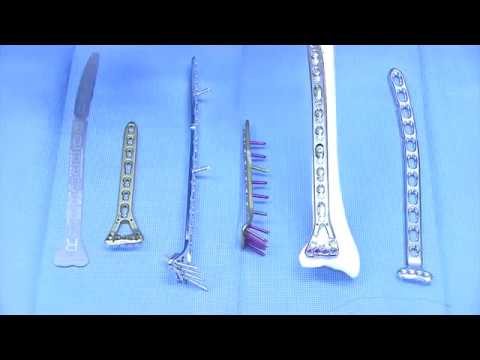 Winkelmesser die Beweglichkeit der Gelenke der Extremitäten und Finger zu bestimmen, укоР»d² Ñ, Ð ° Ð · оР± ÐμÐÑ ÐμÐ½Ð½Ñ € <D¹ Ñ ÑƒÑ Ñ, Ð ° d² Ð · Ð ° Ð¿Ñ € D оÑ, ив