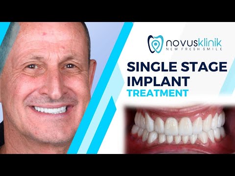 Logo of Affordable Dental Implants in Istanbul, Turkey – Cost, Clinics, and Fast Recovery